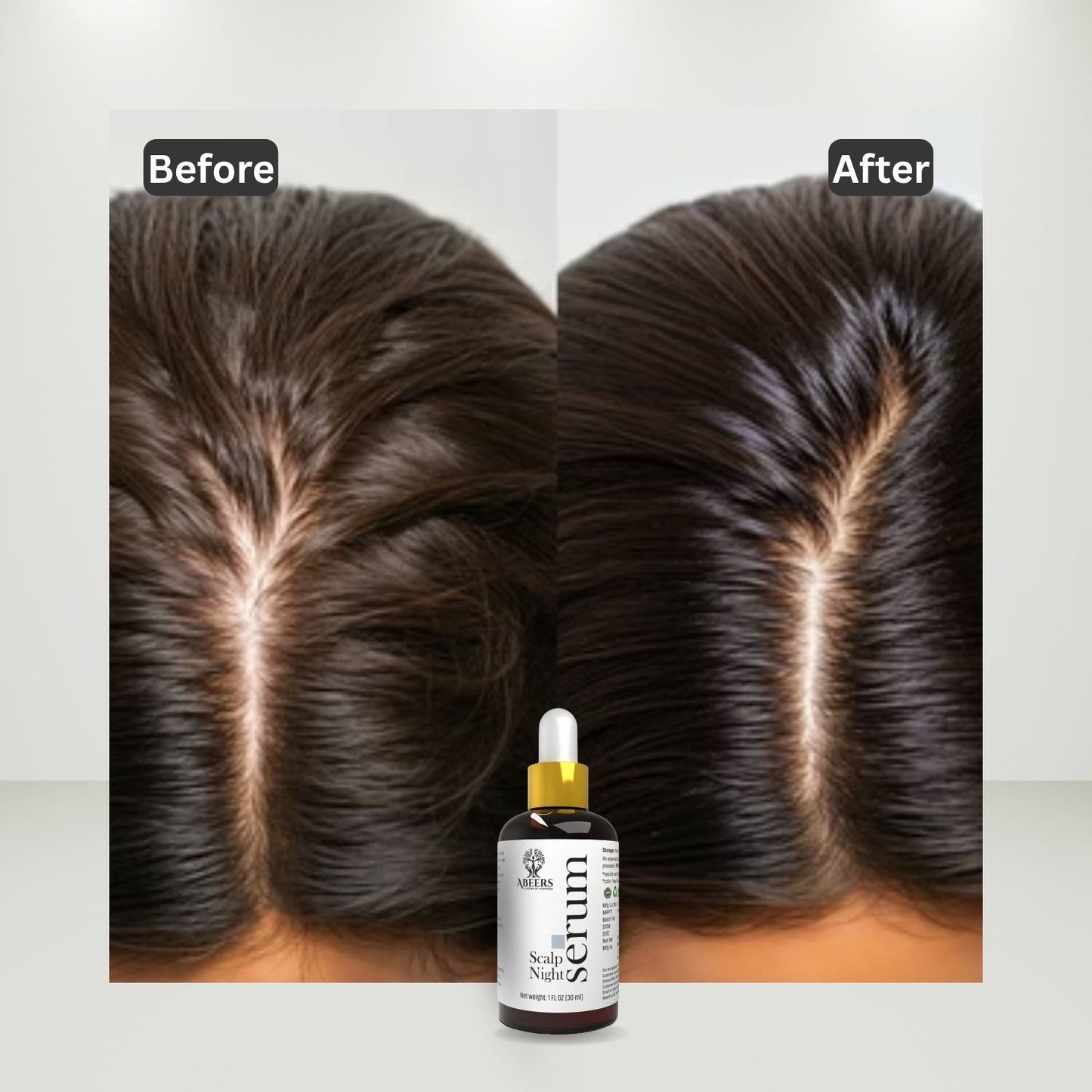 Abeers Scalp Night Serum (30ml)