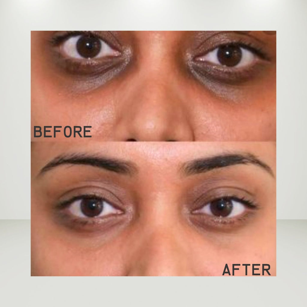 Abeers Curcumin Under Eye Brightening Gel