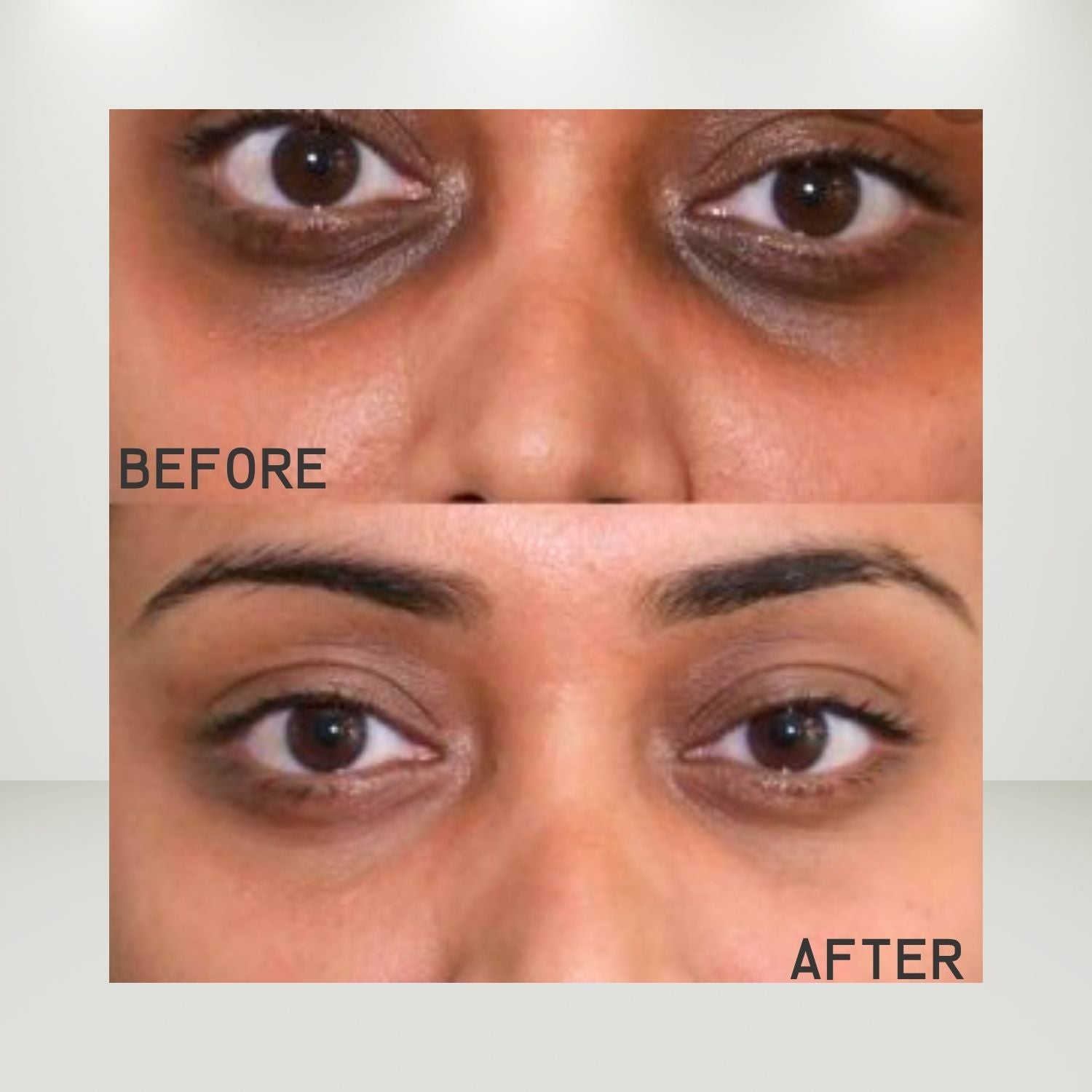 Abeers Curcumin Under Eye Brightening Gel